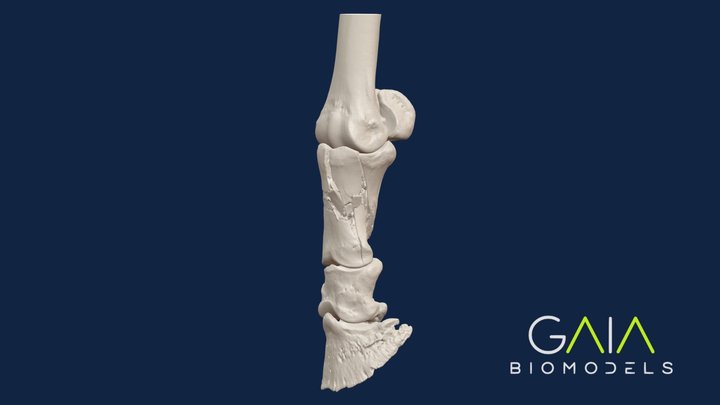 HORSE - First phalanx fracture 3D Model