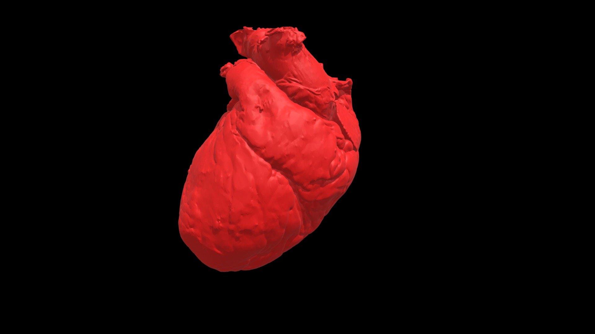 Coronary Artery Disease Model Heart0222 Download Free 3D model by