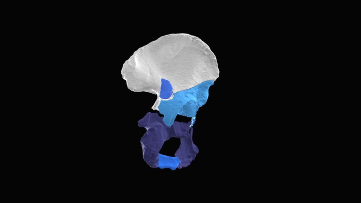 Session 4.03 | Acet. Pararectus vs Ilioinguinal1 3D Model