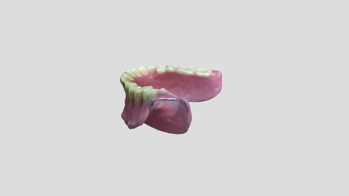 Single Denture Delivery Scan 3D Model