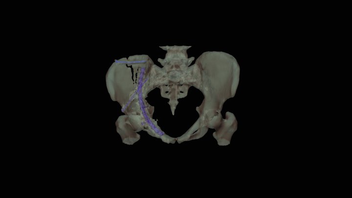 Pelvis Segmentation 3D Model