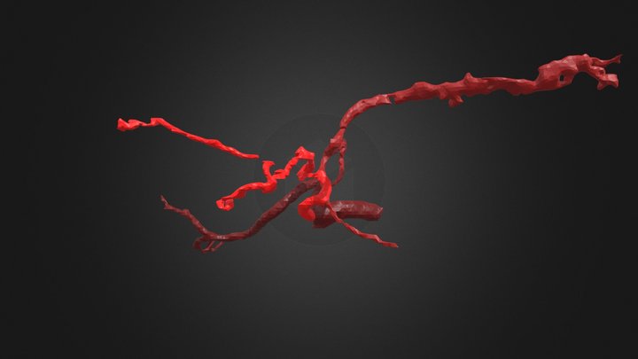 3graft hepatic artery 3D Model