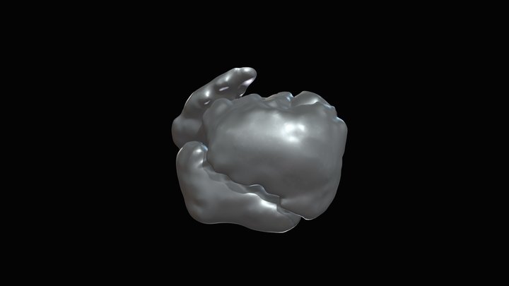 CC-Heart with virtual patch- Cut at AVV level 3D Model