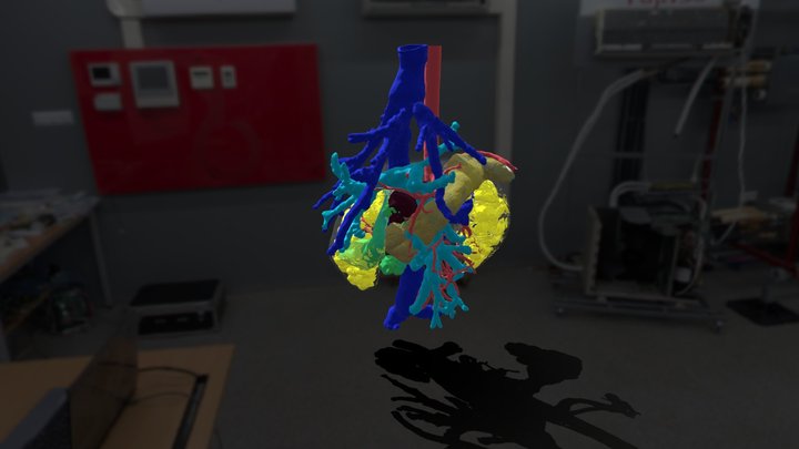 Radiology_paediatric 3D models - Sketchfab