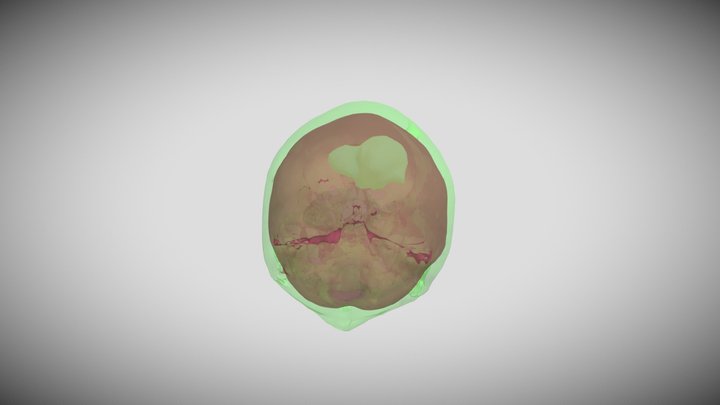 Exam 3 Question 2G Segmentation 3D Model
