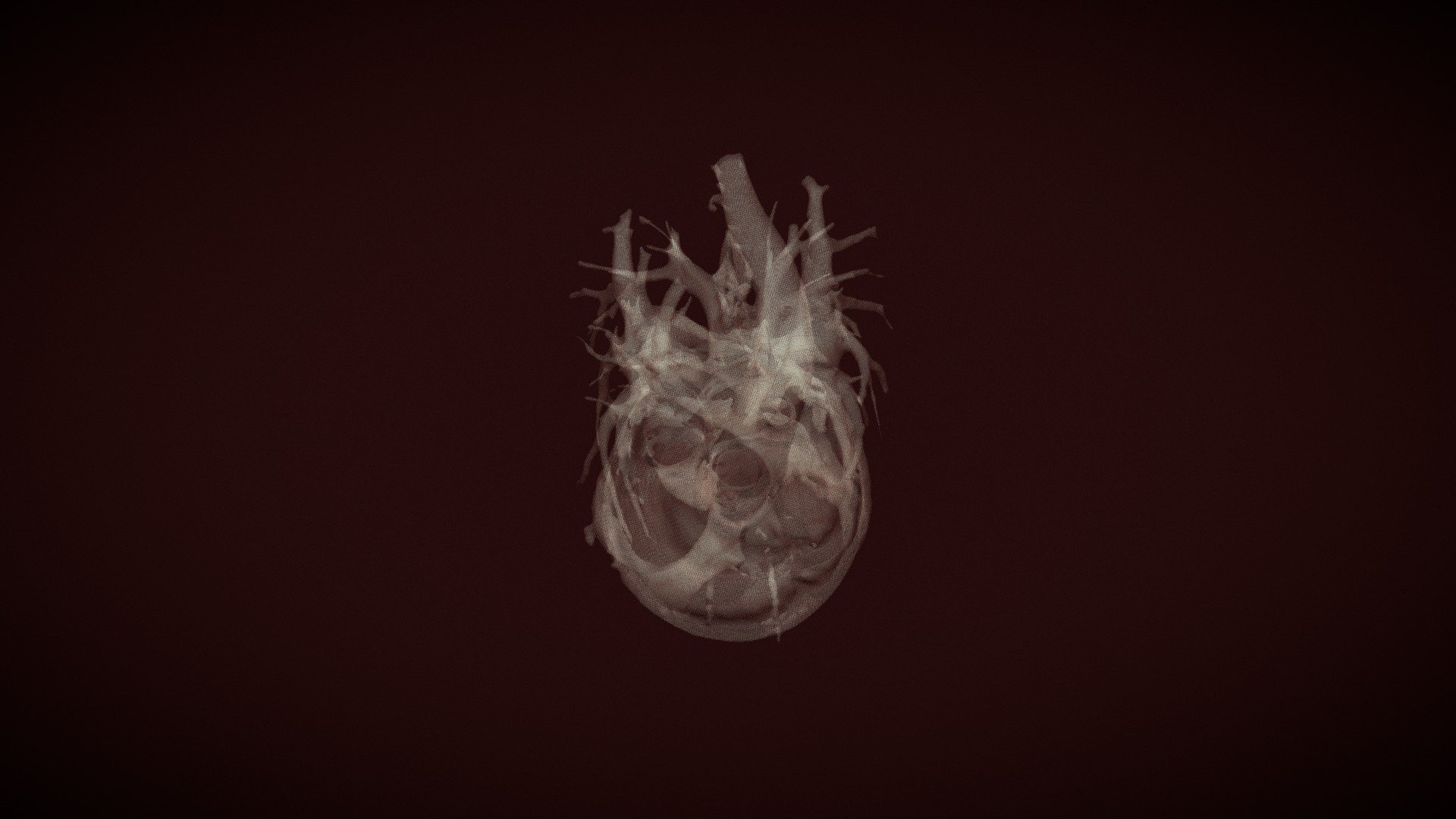 Normal: Heart