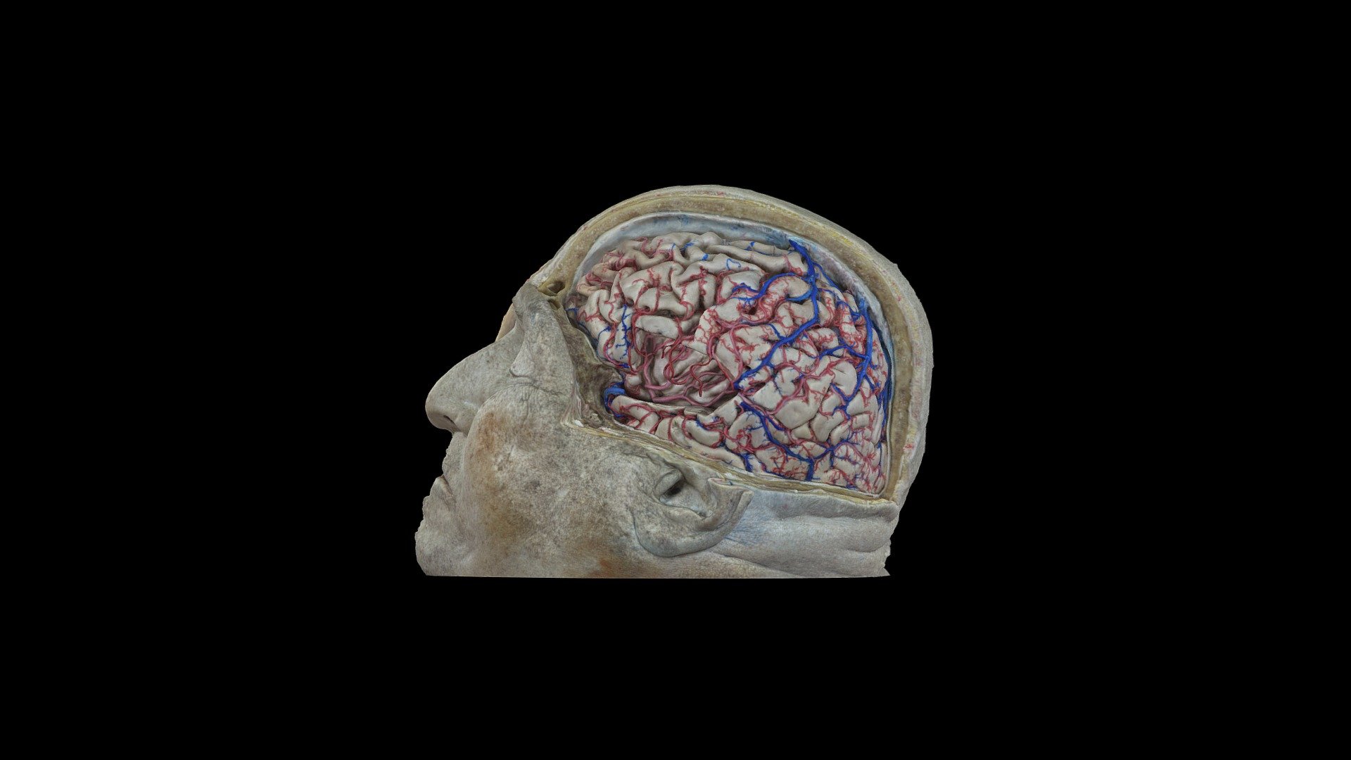 insular project 2 (no veins) - 3D model by Rhoton Neurosurgery ...