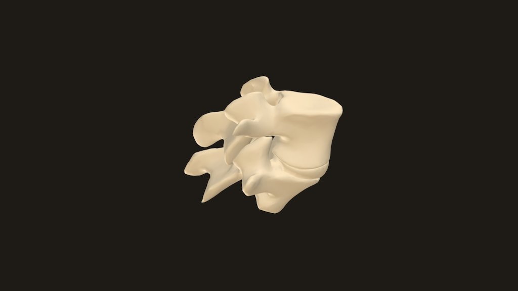 L1-L2+discus - 3D model by gramanox [1588ba1] - Sketchfab