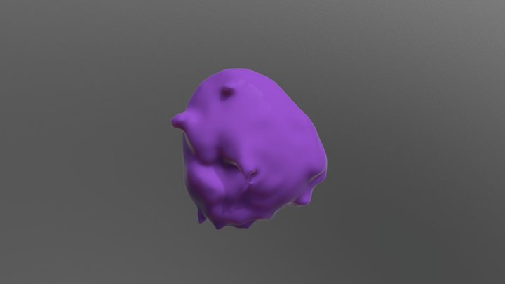 Aneurysm 3D Model