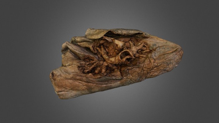 Right Lung Medial 3D Model