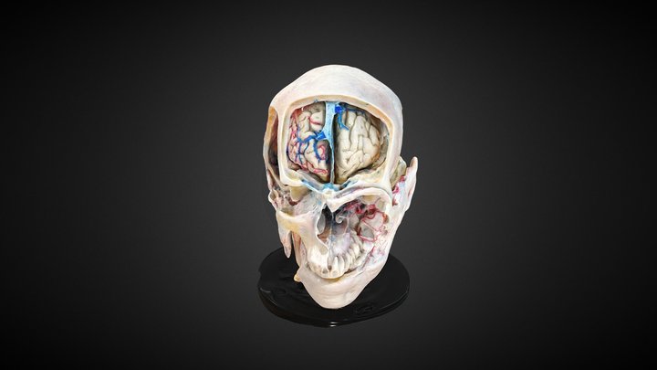 6+1 Approaches 3D Model