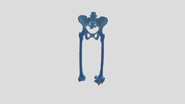 Femur_Segmentation 3D Model