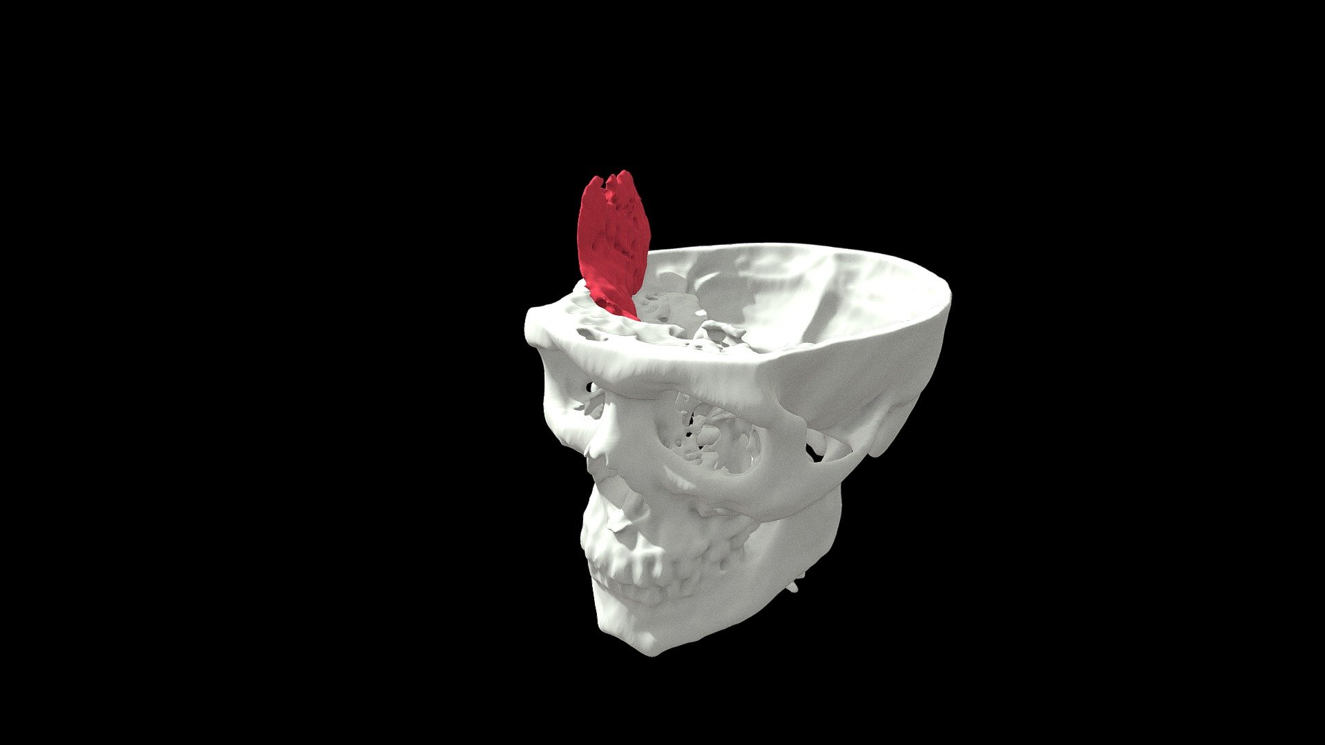 Interaktywny Atlas Ciekawych przypadków ID:004A1 — Sketchfab embed 3D viewer
