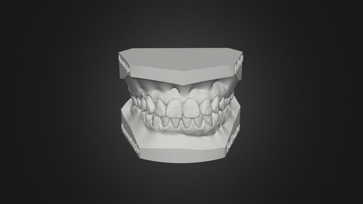 Modelo Ortodontico Radicenter 3D Model