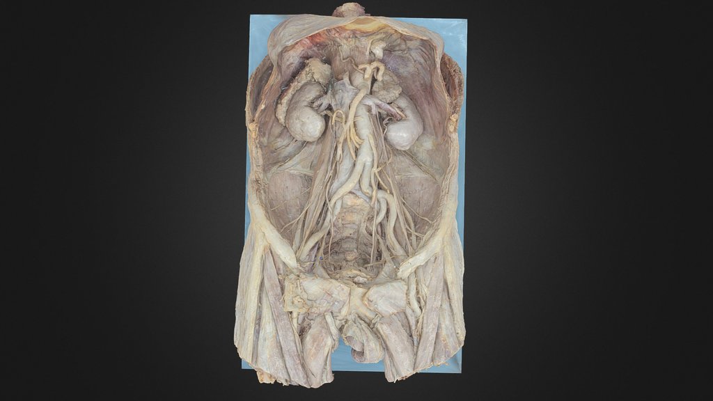 Anatomy models - A 3D model collection by UoM_Anatomy - Sketchfab