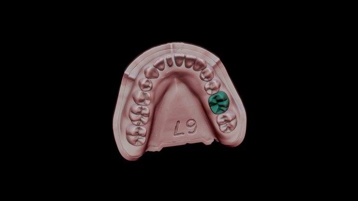 #30 on Full Mandibular Dentoform 3D Model