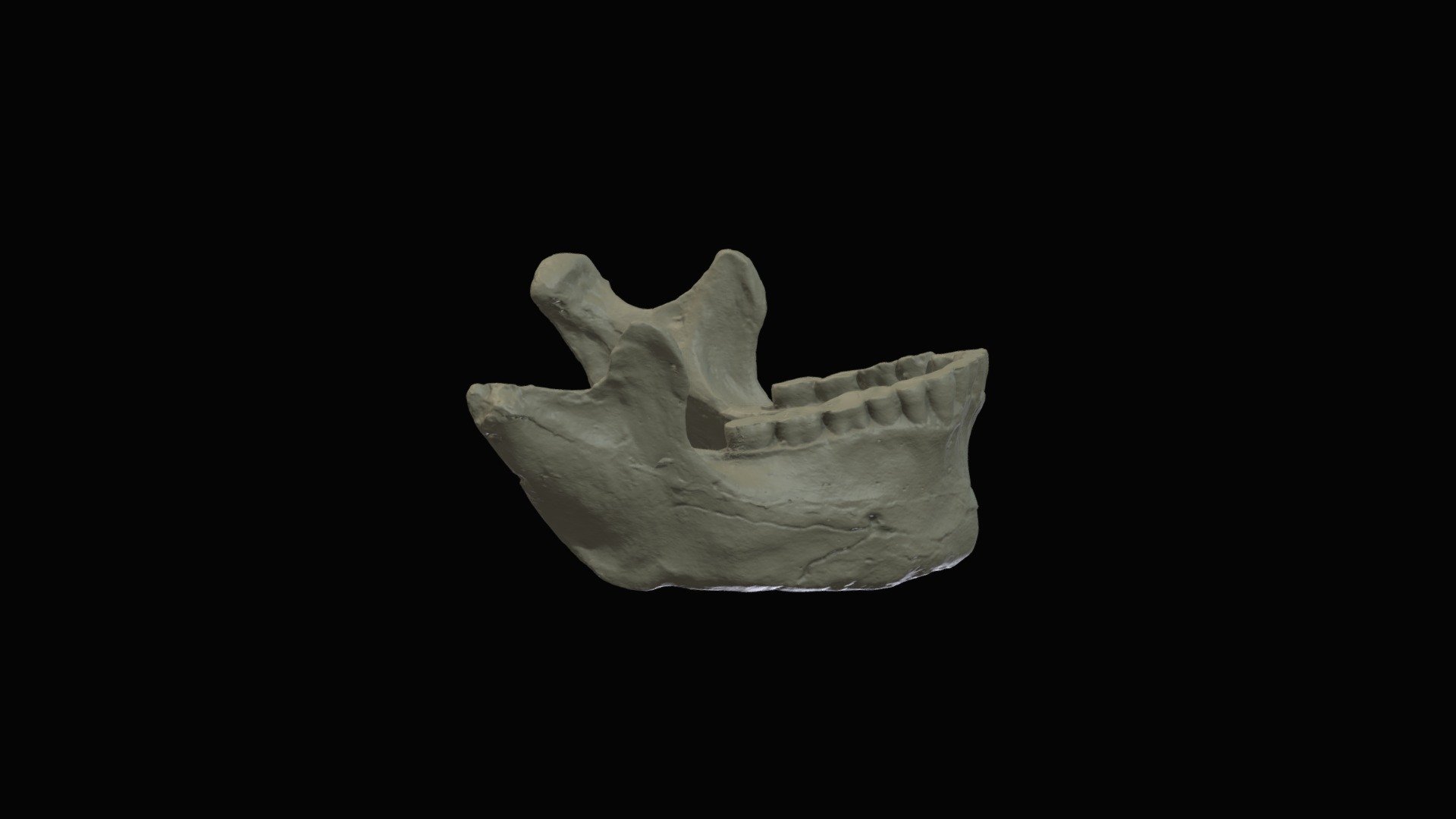 Homo Neanderthalensis (Tabun) Mandible