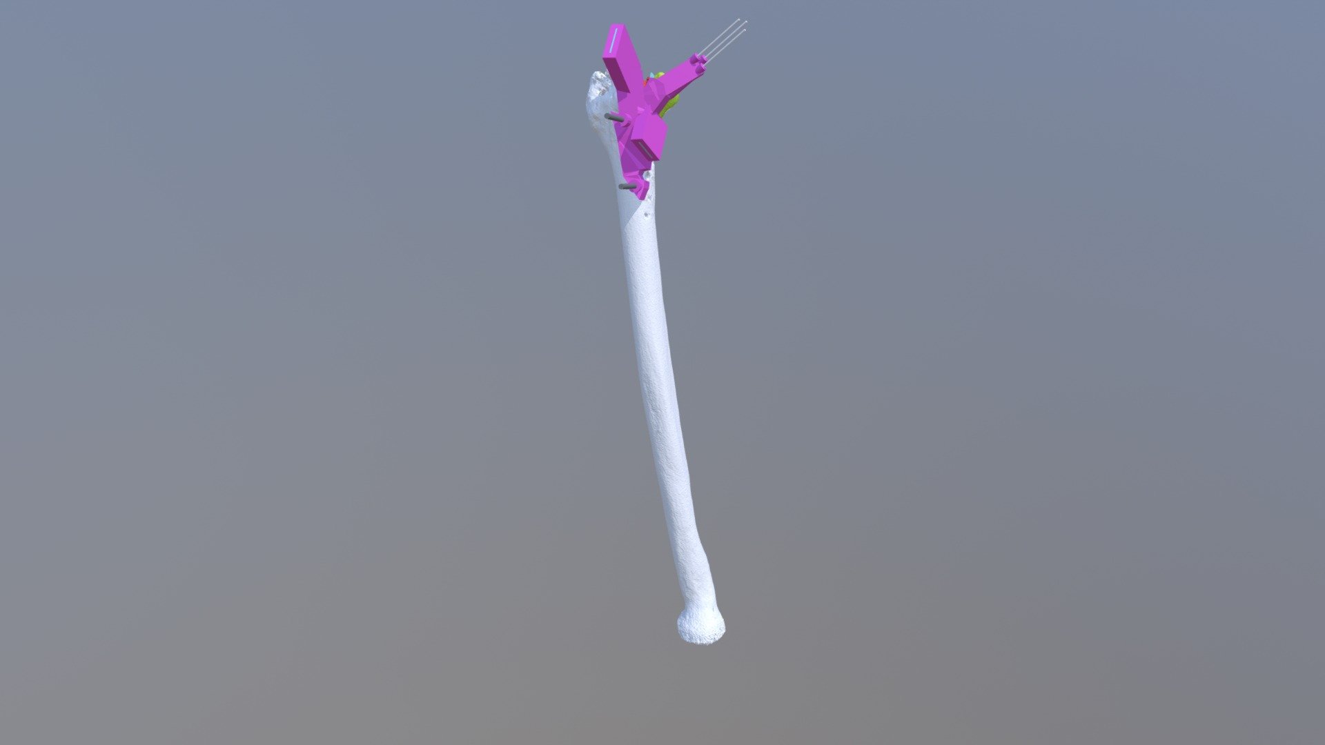 R_ROD Guide 01 dorsal