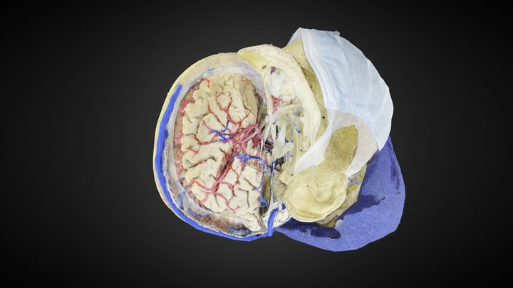 HEMISFERIO CS 3D Model