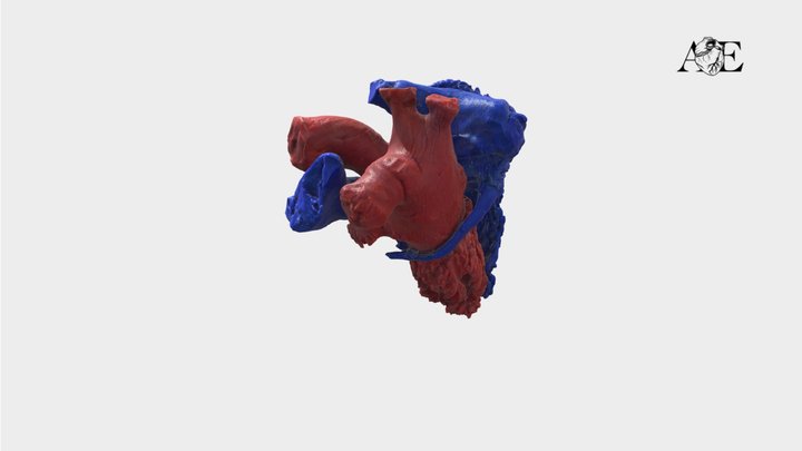 Endocast of a human postmortem heart 3D Model