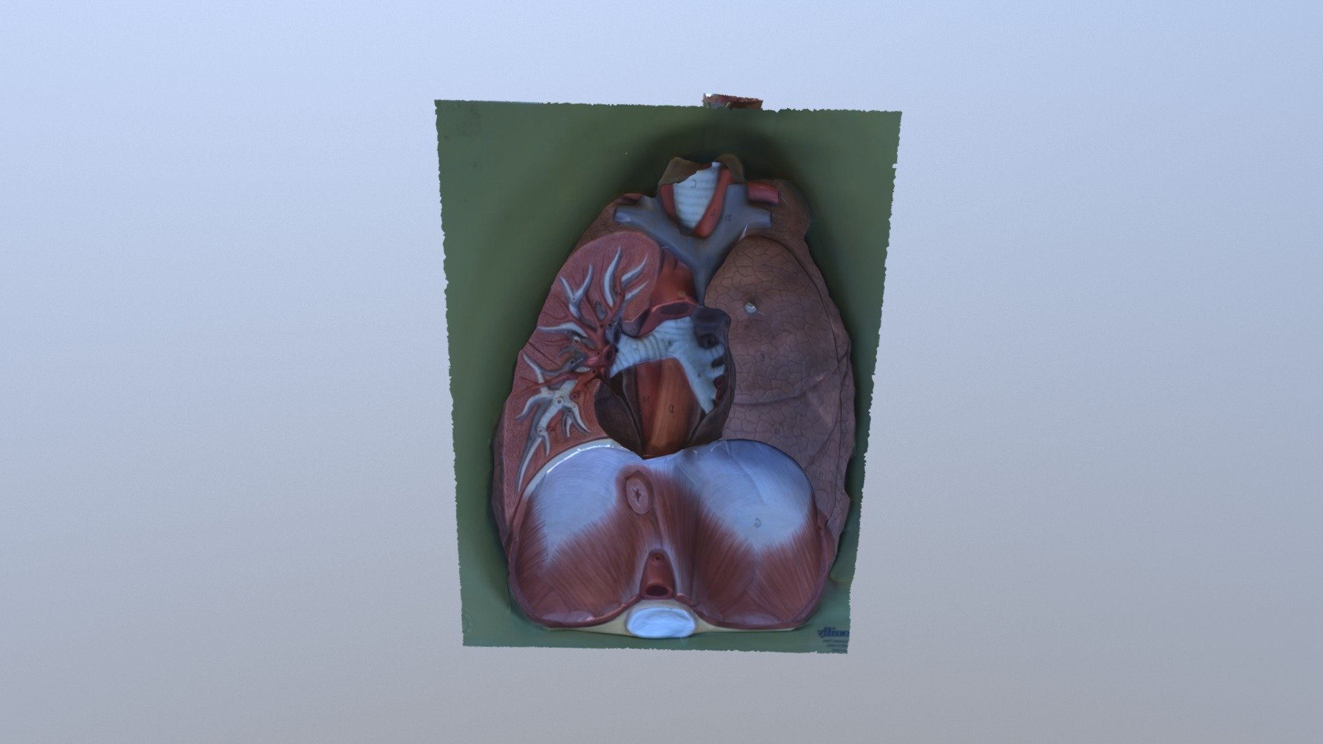 3D Lungs 2