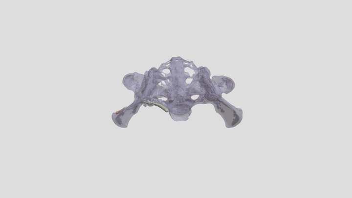 Berall_Pelvix Segmentation 3D Model