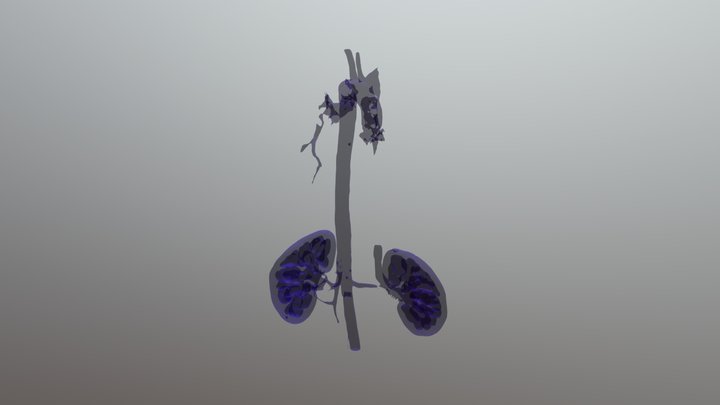 Kidneys + Aorta 3D Model