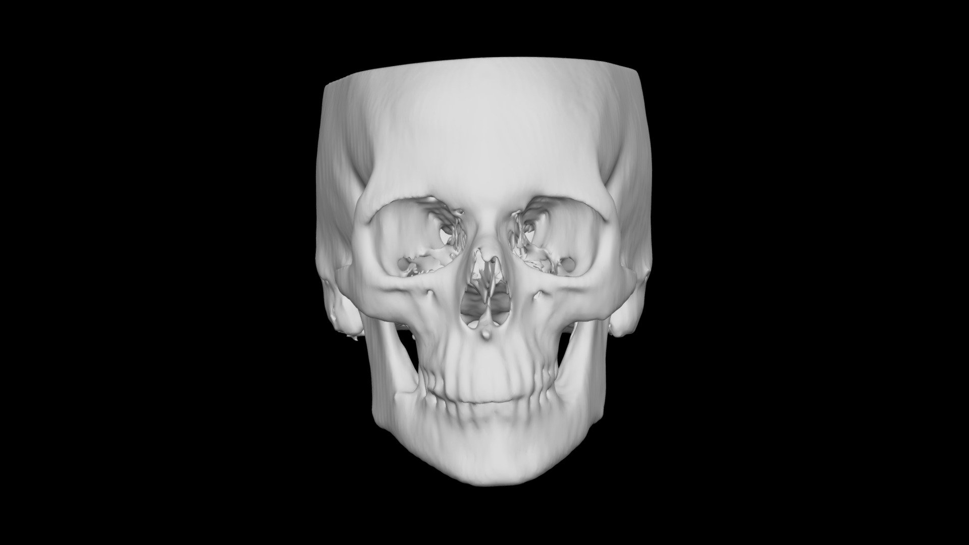 Skull Female 21yo