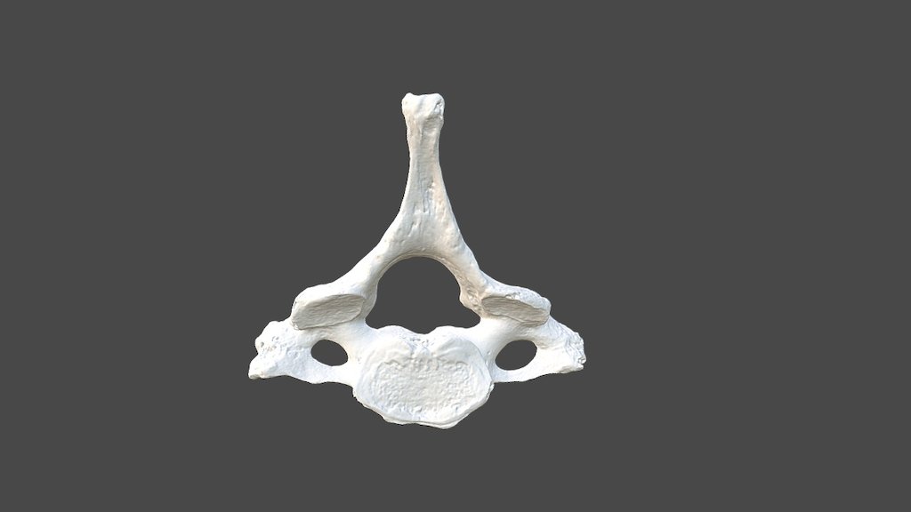 Cervical Vertebra 4