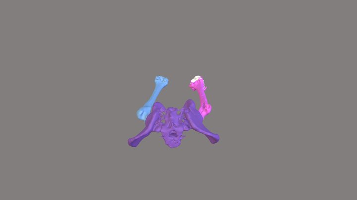 Femur and Pelvis Segmentation 3D Model