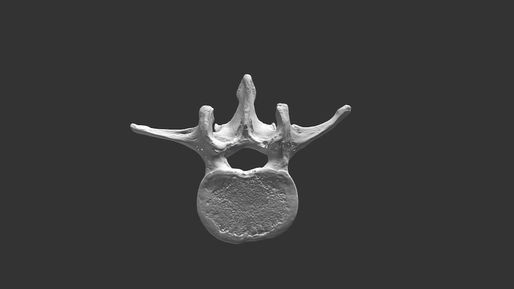 Lumbar Vertebra