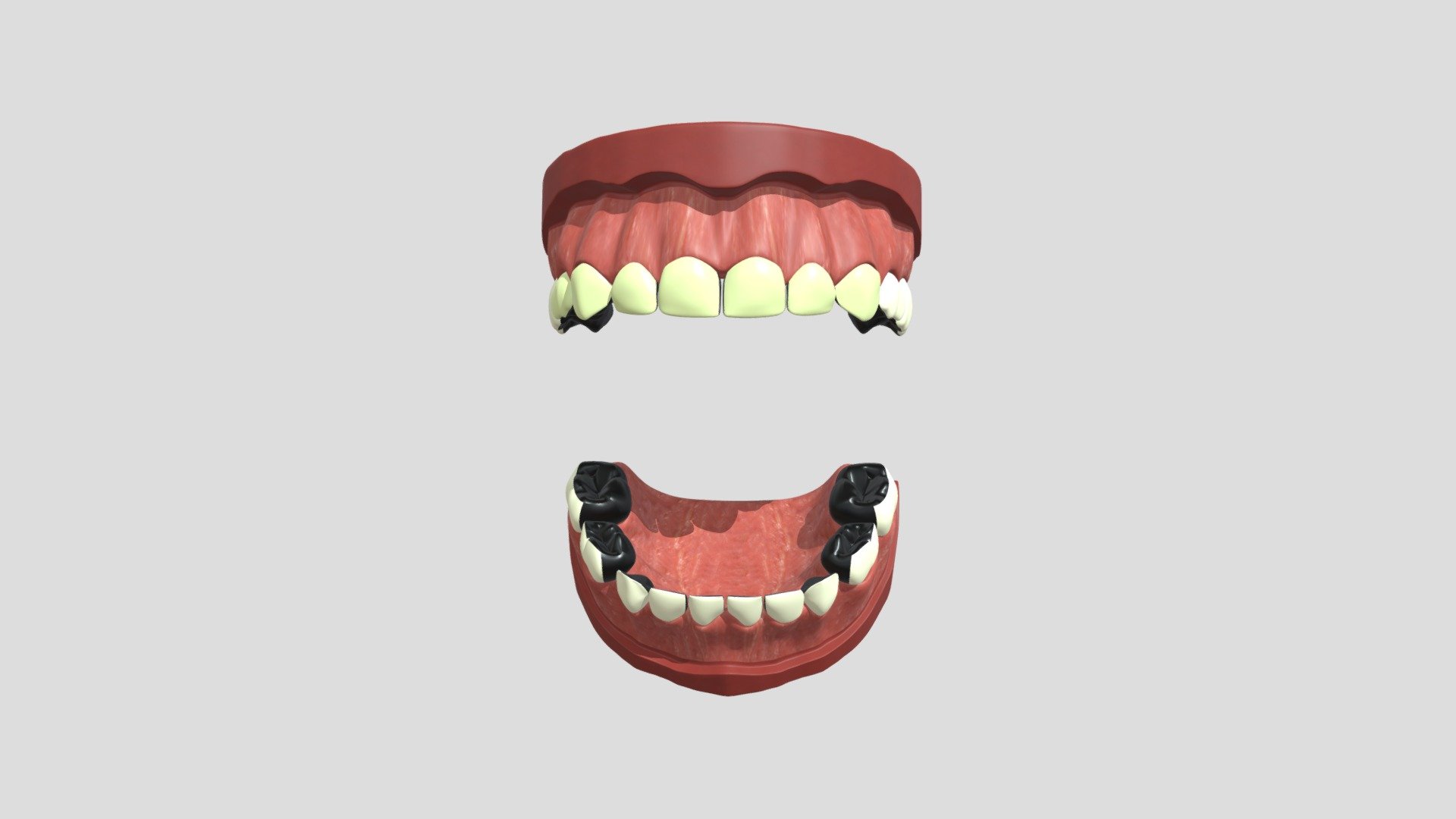 hypo_nzunrestored_3cm_1c