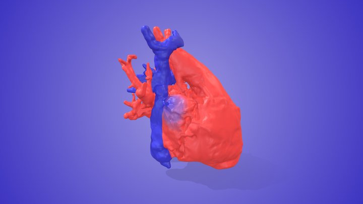 Fenestrated Fontan Myocardial 3D Model