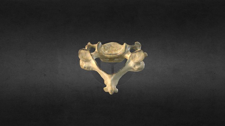 Vértebra Cervical Típica/Cervical Vertebra 3D Model