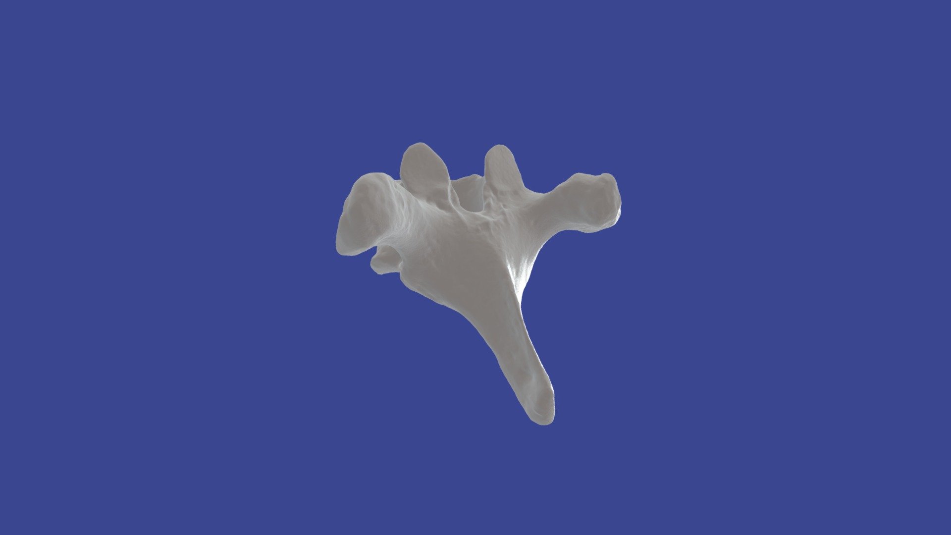 Thoracic vertebra (T6)