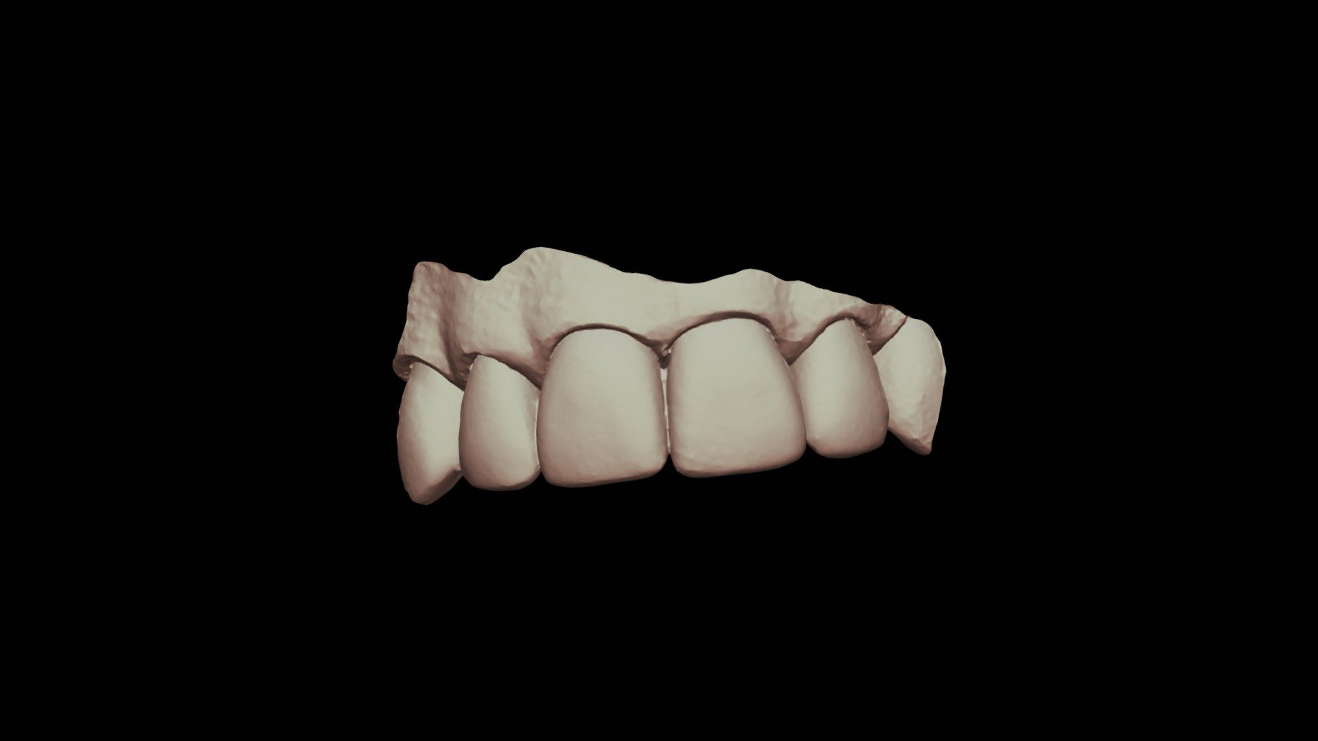 9 Class 3, Group 7, 6 Dp Upper Jaw