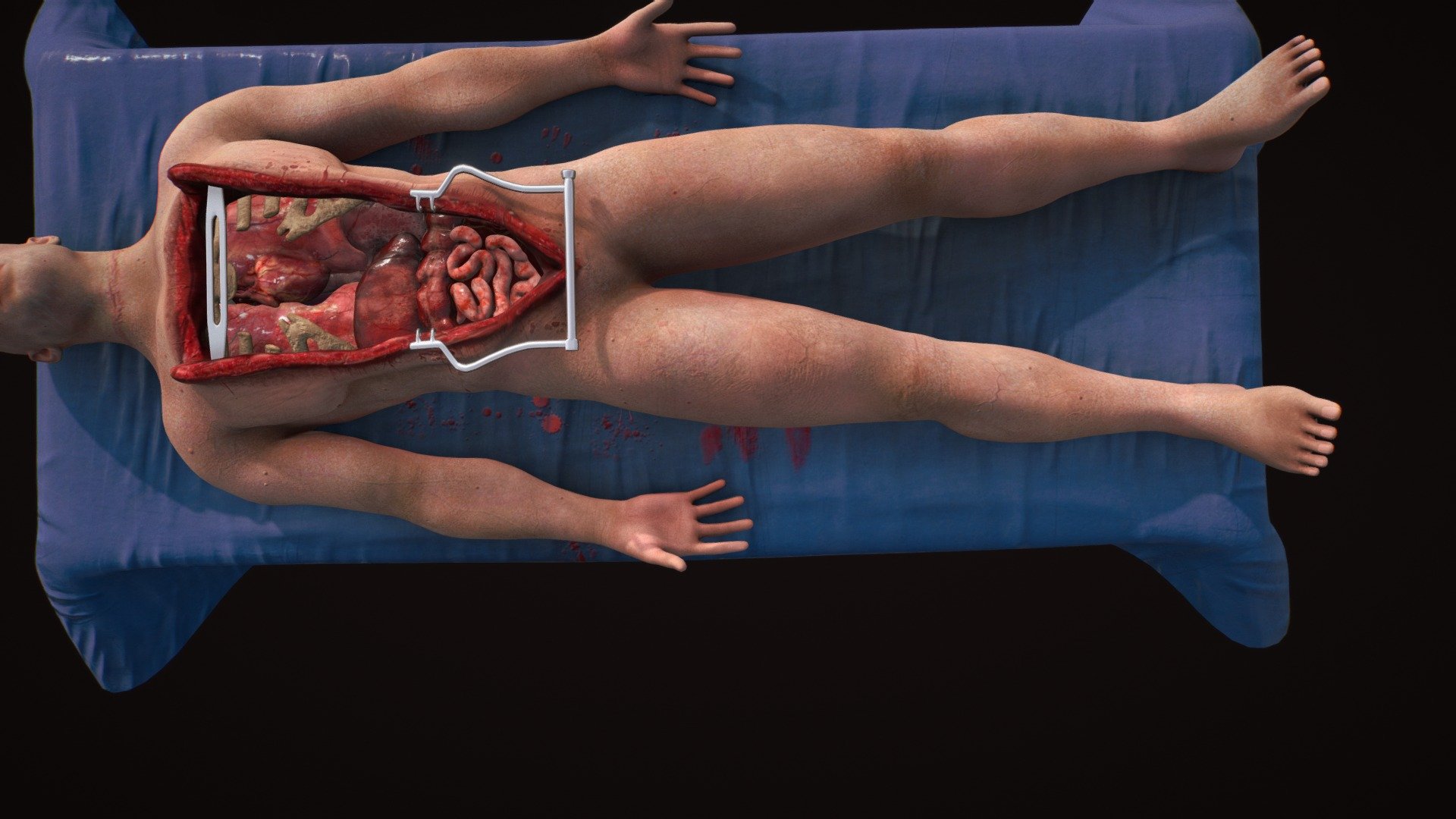 An Autopsy - 3D model by artmellows.