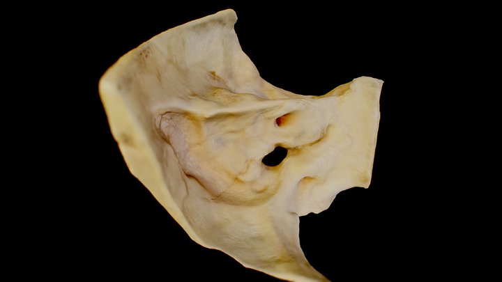 Left Temporoccipital Region