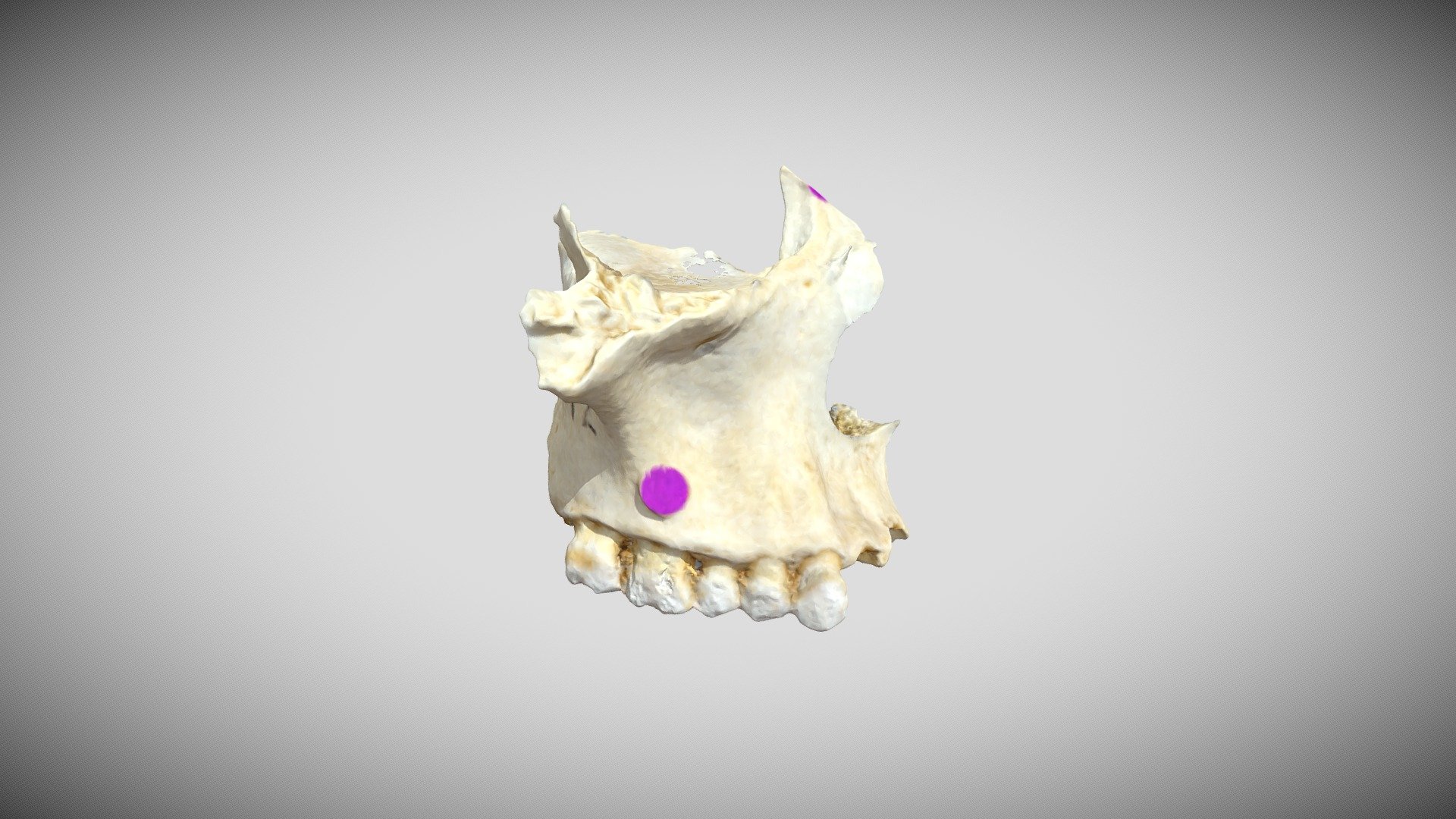Maxilla (Labeled) Final