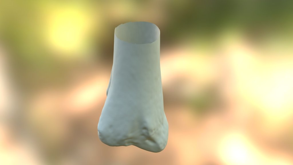 Distal Tibia Warm