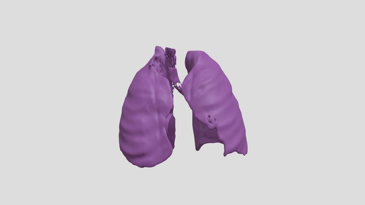 Segmentation_lungs 3D Model