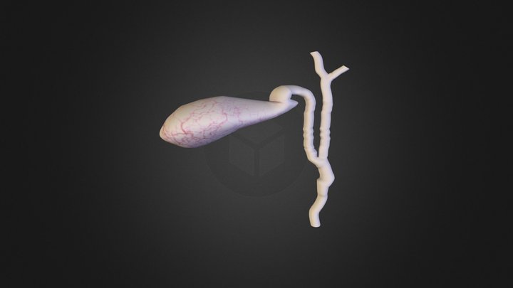 Low union with common hepatic duct 3D Model