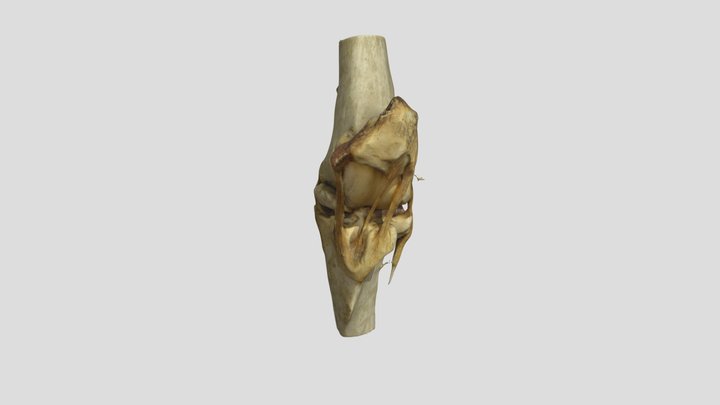Meniscus 3D models - Sketchfab