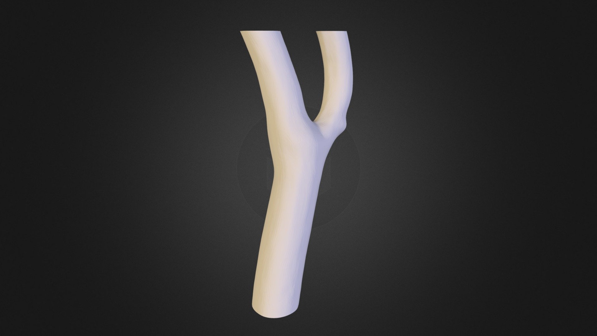 Human Carotid Bifurcation - 3D model by 3dindustries [1bbf1b8] - Sketchfab