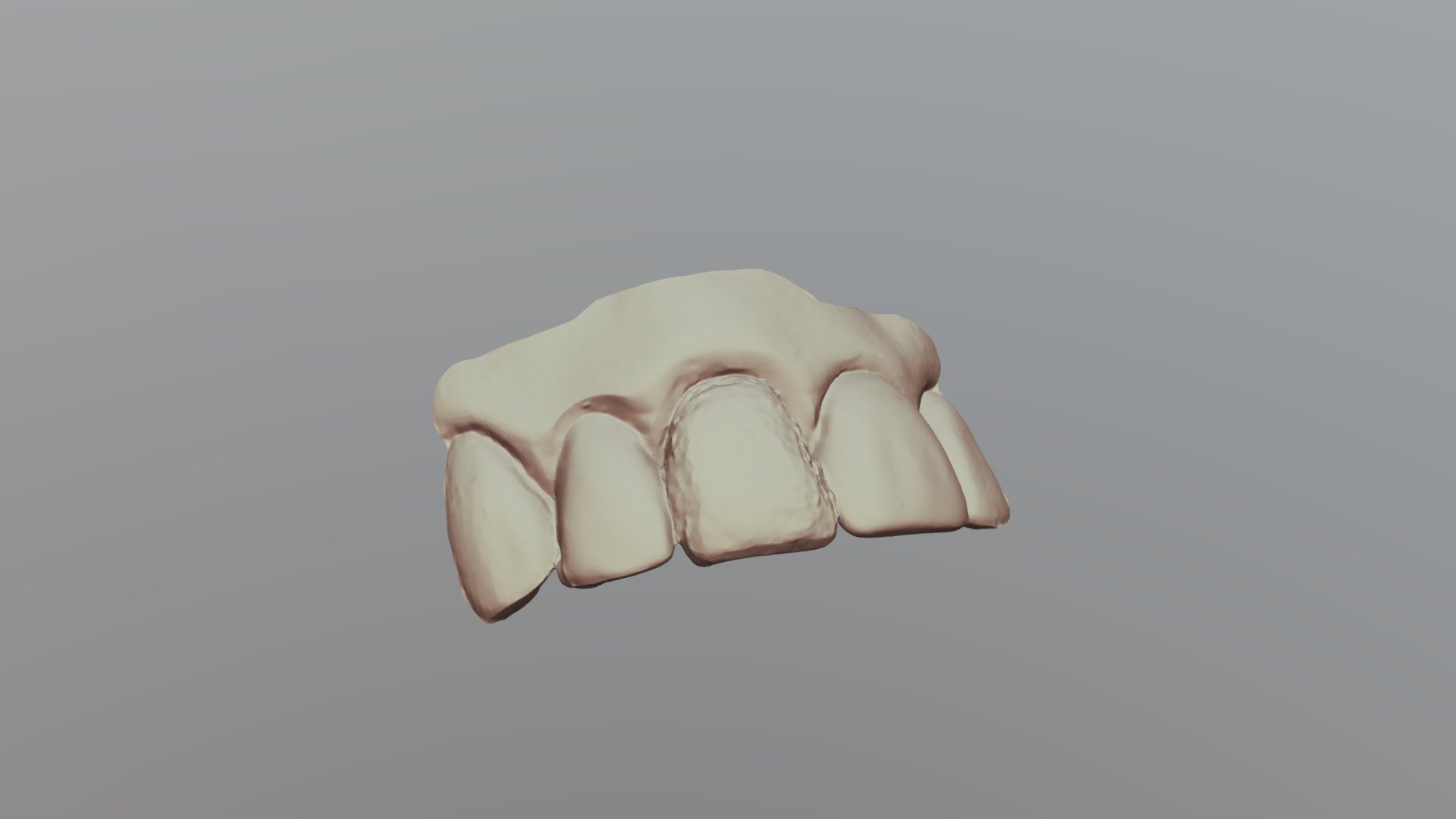 Group 2 8a Upper Jaw