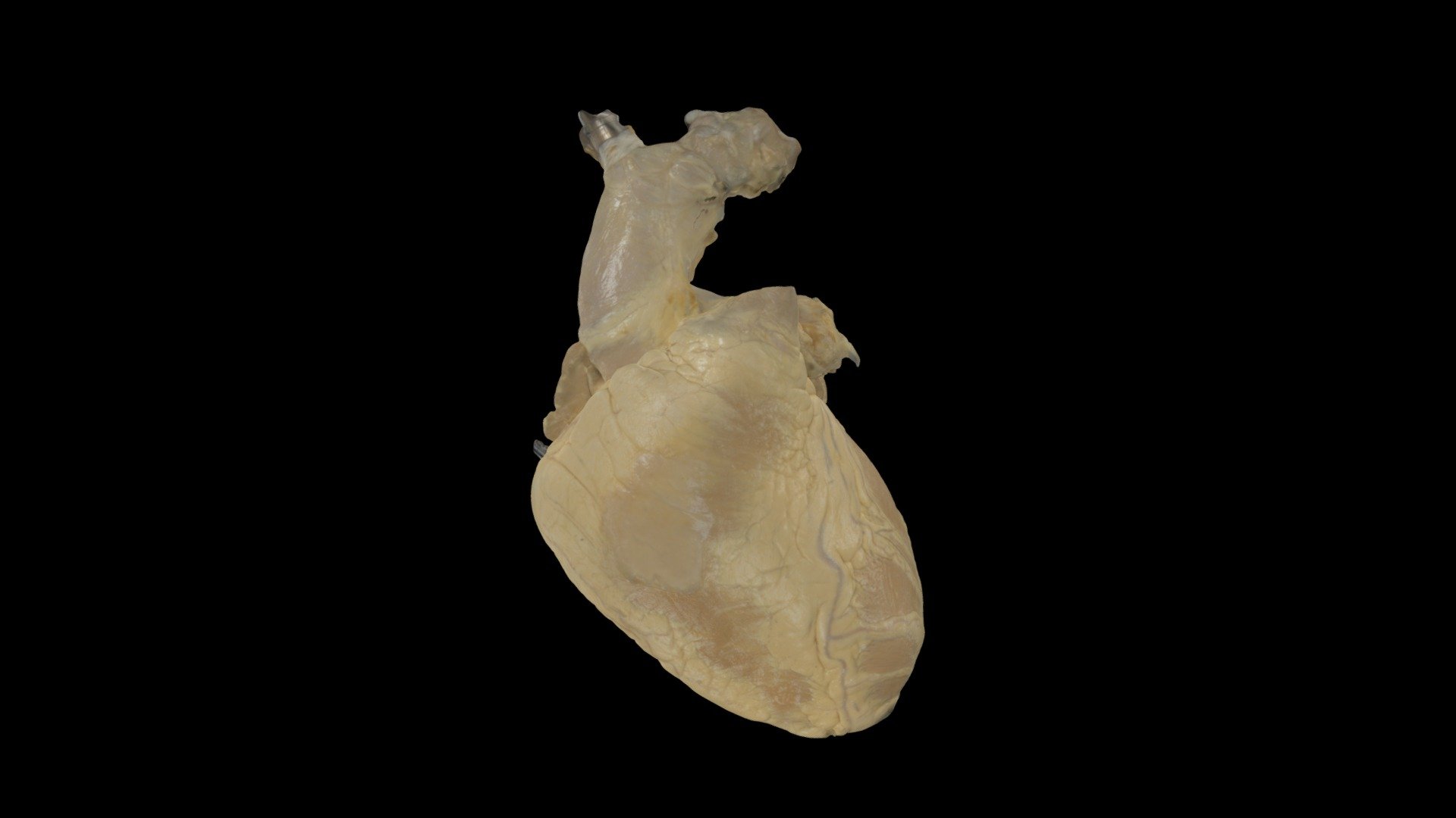 Perfusion Fixed Human Heart