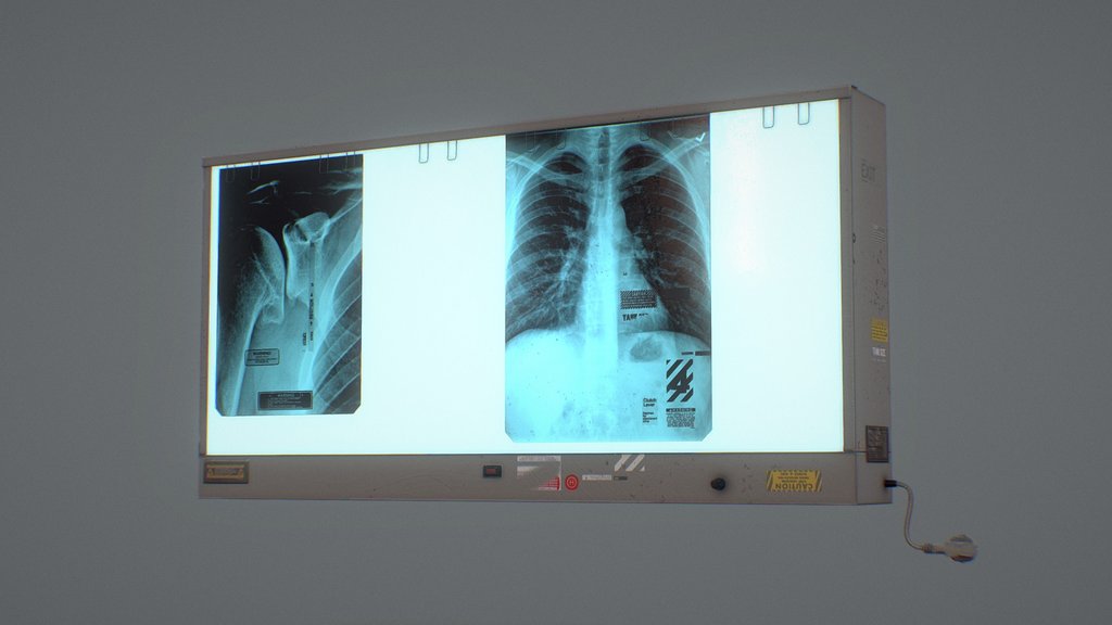 Medical X-ray Image Viewer - 200 Uploads!