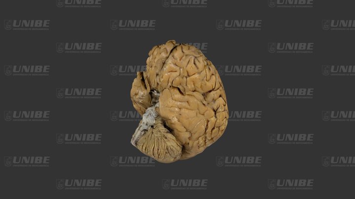 Vista frontal (anterior) 3D Model