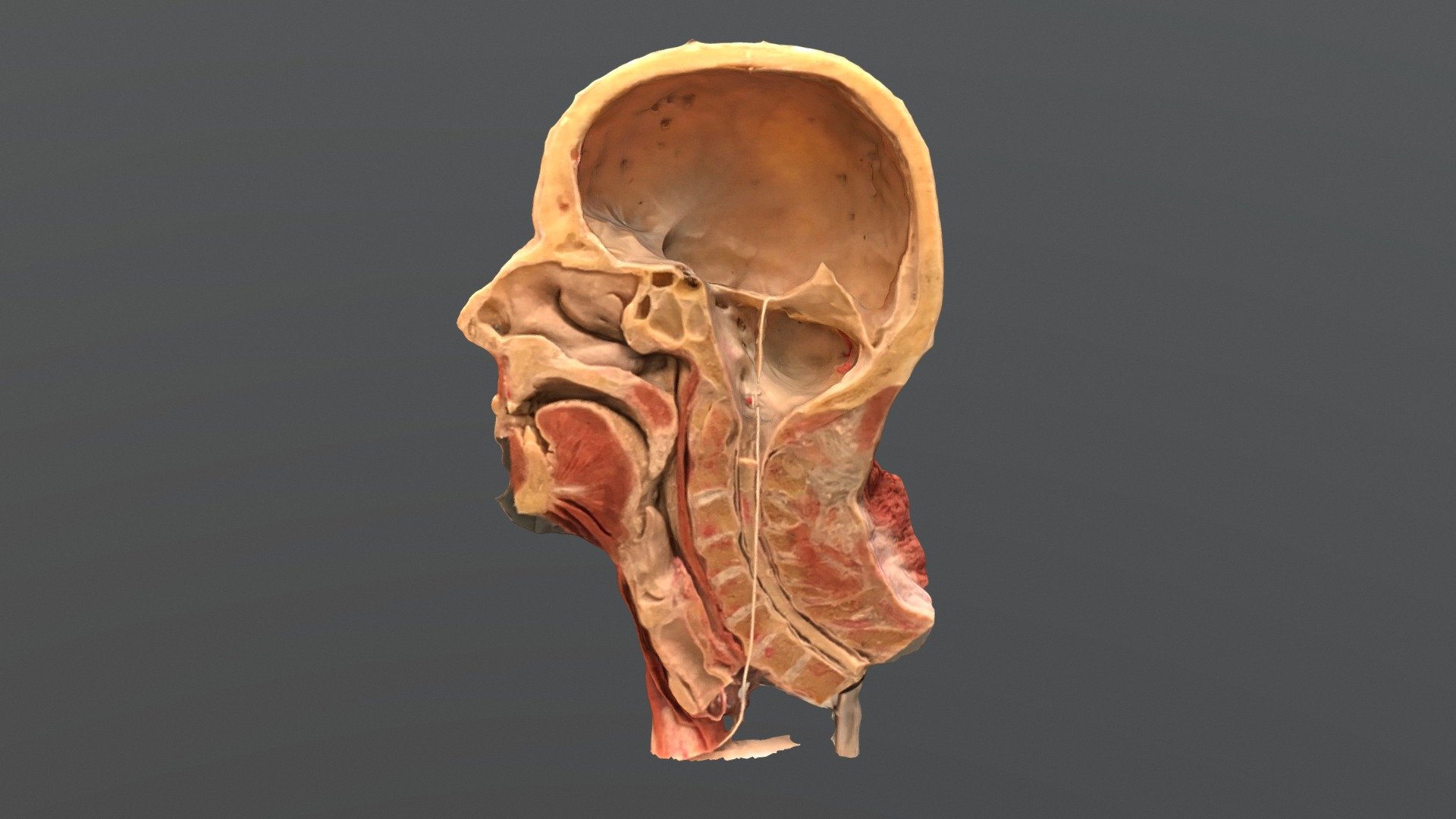 Plastination 001 3D model by ScienceLifeNY [1d31857] Sketchfab