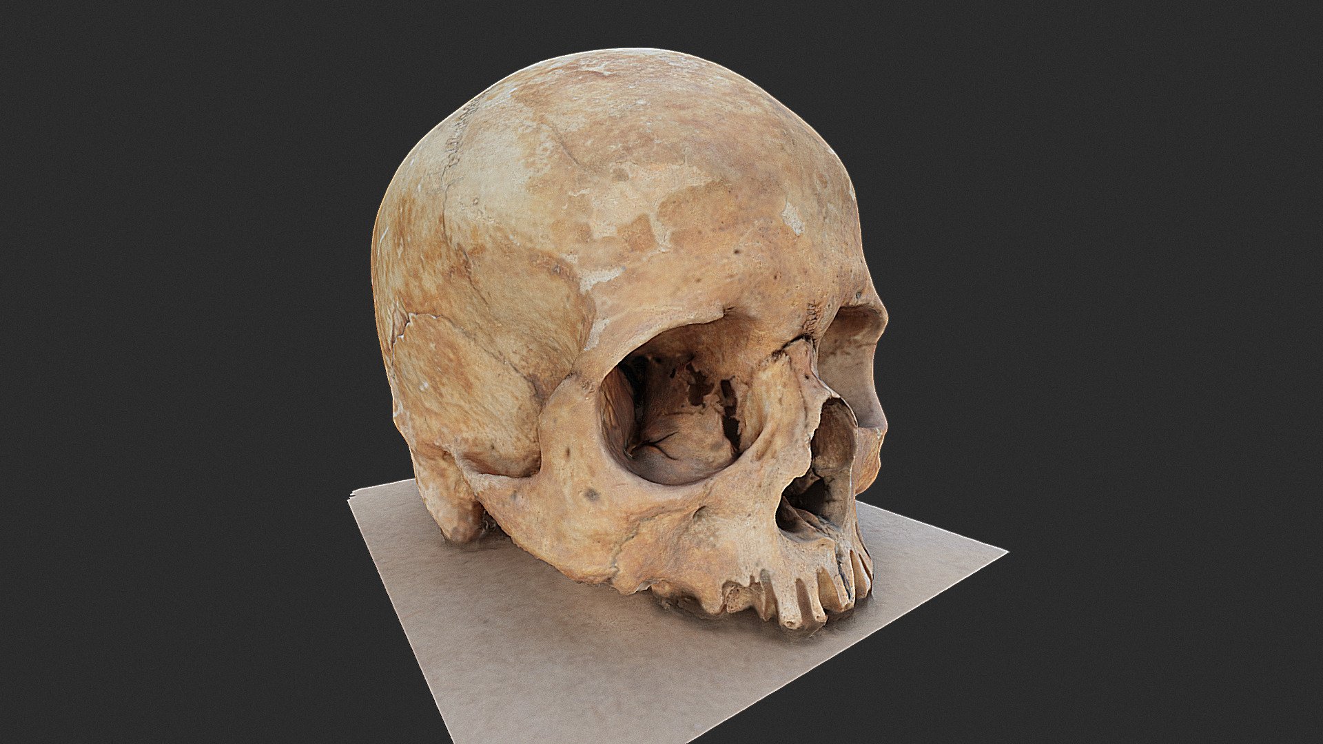Skull